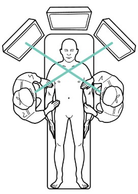 Illustration of two surgeons operating on patient. Green lines show surgeons looking at screens diagonally across from them