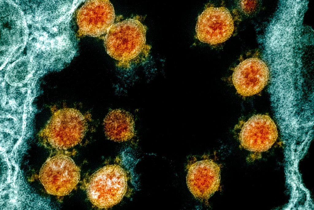 Microscope image of the SARS-COV-2 virus.
