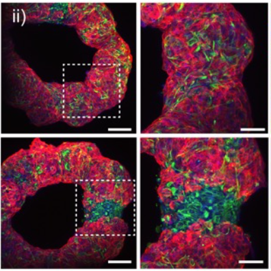 Microscope images comparing tissue models with and without scarred regions.