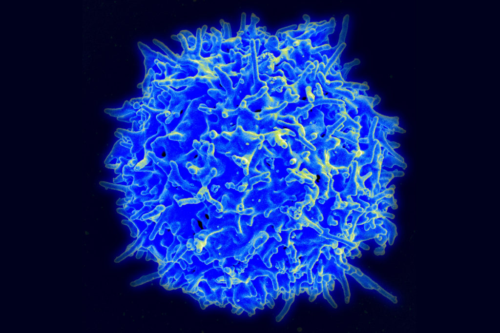 Scanning electron microscope image of a T cell
