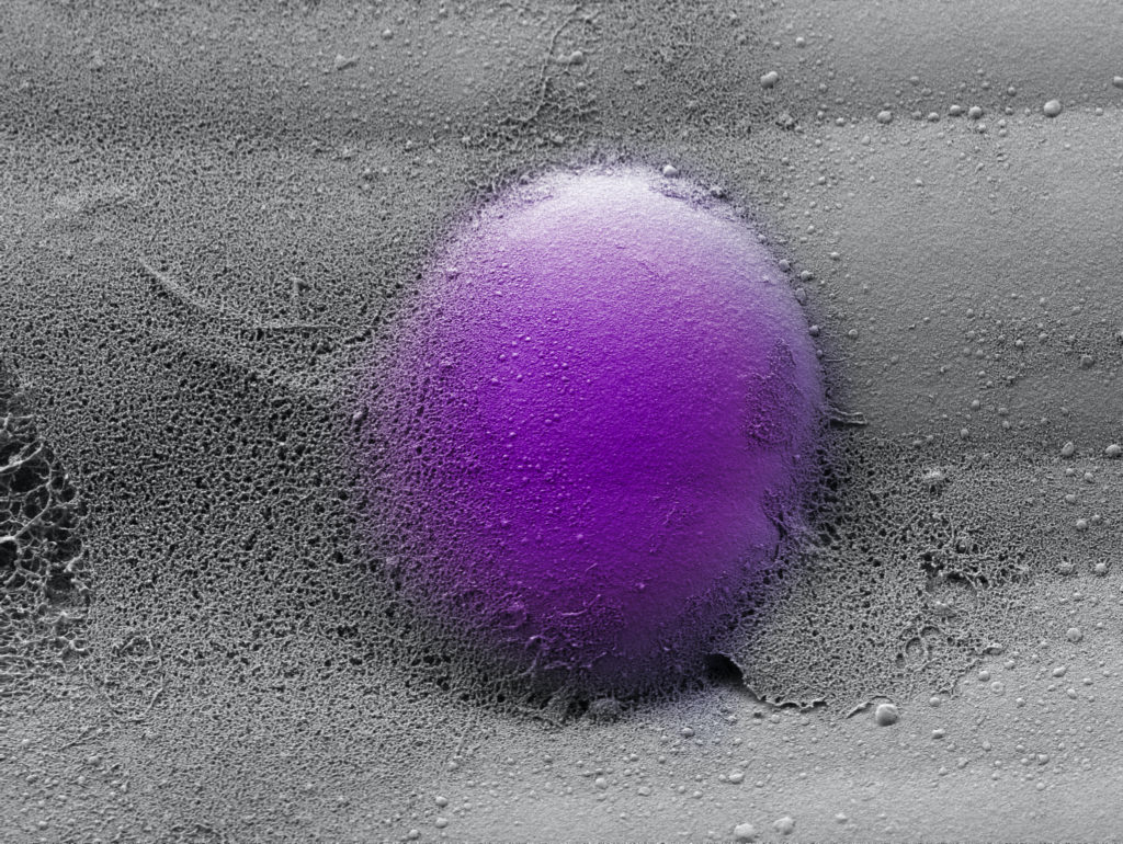 A microscope image of a monocyte, colored purple.
