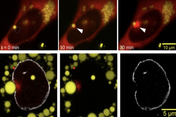 Fat droplets able to damage a cell's nucleus