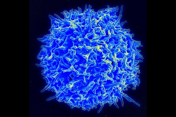 A healthy human T cell