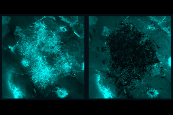 The picture above shows a before (left) and after (right) fluorescence image of fungal biofilms being precisely targeted by nanozyme microrobots without bonding to or disturbing the tissue sample. (Image: Min Jun Oh and Seokyoung Yoon)