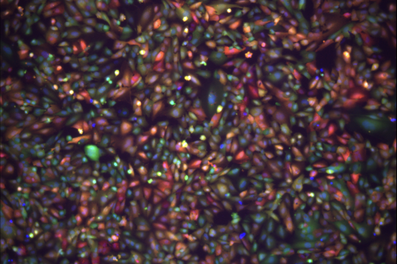 Fluorescence microscopy image showing LNPs delivering fluorescent protein (mCherry) mRNA to brain endothelial cells. Cells are shown in green and their nuclei are shown in blue. Cells that are red were transfected by LNPs, where the newly expressed mCherry protein results in red fluorescence.