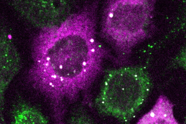 Cells stained magenta and green against a black background. Bright white spots within the cells represent clusters of proteins detected by CluMPS.