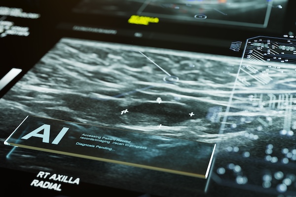 Illustration of AI scanning a mammogram