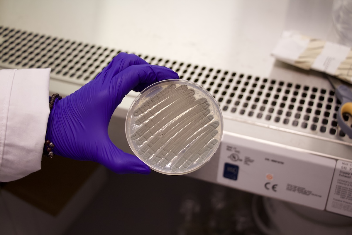 A gloved hand holds a petri dish with mold. 